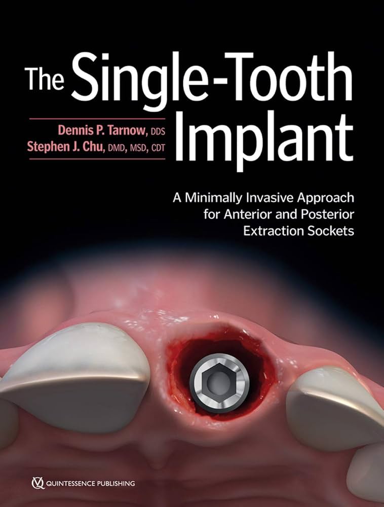 健康・医学 Implant Dentistry: Theory and Practice Implant Dentistry : A Practical Approach by Arun K. Garg